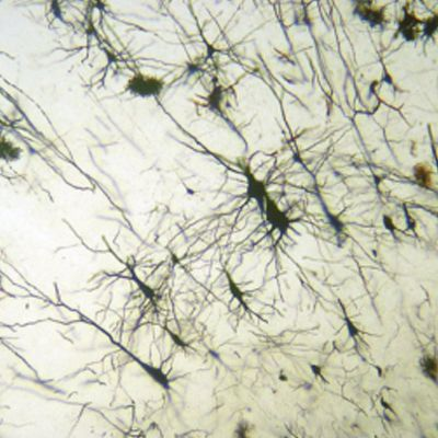 https://msimg.bioon.com/bionline/goods-no-pic.png