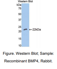 https://msimg.bioon.com/bionline/goods-no-pic.png