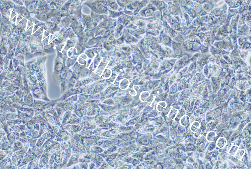 https://img.medsci.cn/5f561f9d1966c8a40c069b97fcac23b82666d7612246dbae75064de0bed04333.png