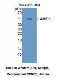 人细胞周期素B2(CCNB2)多克隆抗体