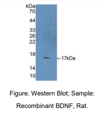 大鼠脑源性神经营养因子(BDNF)多克隆抗体