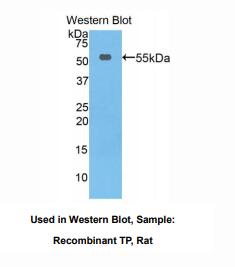 https://msimg.bioon.com/bionline/goods-no-pic.png