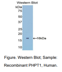 https://msimg.bioon.com/bionline/goods-no-pic.png