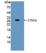 人含胶原三螺旋重复蛋白1(CTHRC1)多克隆抗体