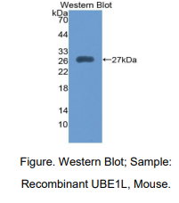 https://msimg.bioon.com/bionline/goods-no-pic.png