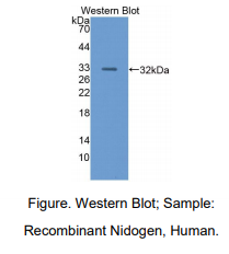 https://msimg.bioon.com/bionline/goods-no-pic.png