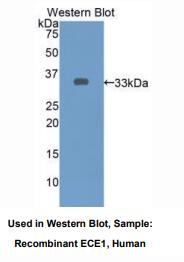 人内皮素转化酶1(ECE1)多克隆抗体