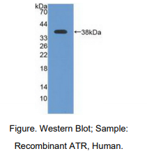 人共济失调毛细血管扩张Rad3相关蛋白(ATR)多克隆抗体