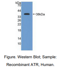 https://msimg.bioon.com/bionline/goods-no-pic.png