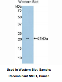 人非转移细胞1表达NM23A蛋白(NME1)多克隆抗体