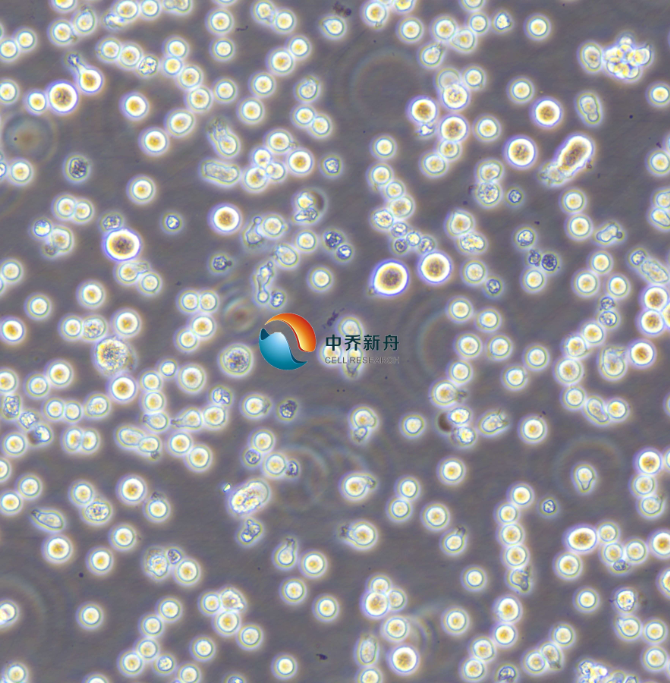https://img.medsci.cn/8eee53bbc4cb7a98de615e72115896bc4e27fda5cbb764dbd67d9d641c2bb46a.png