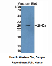 https://msimg.bioon.com/bionline/goods-no-pic.png