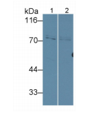 大鼠基质金属蛋白酶2(MMP2)多克隆抗体