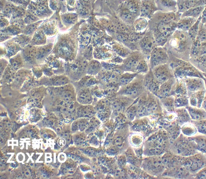 人甲状腺癌细胞TTA1