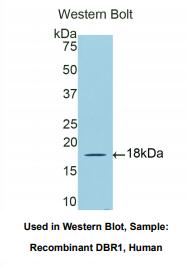 人脱支酶同源物1(DBR1)多克隆抗体