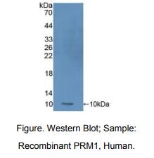 人鱼精蛋白1(PRM1)多克隆抗体