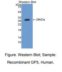 人糖蛋白Ⅴ(CD42d)多克隆抗体