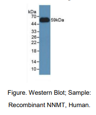 https://msimg.bioon.com/bionline/goods-no-pic.png