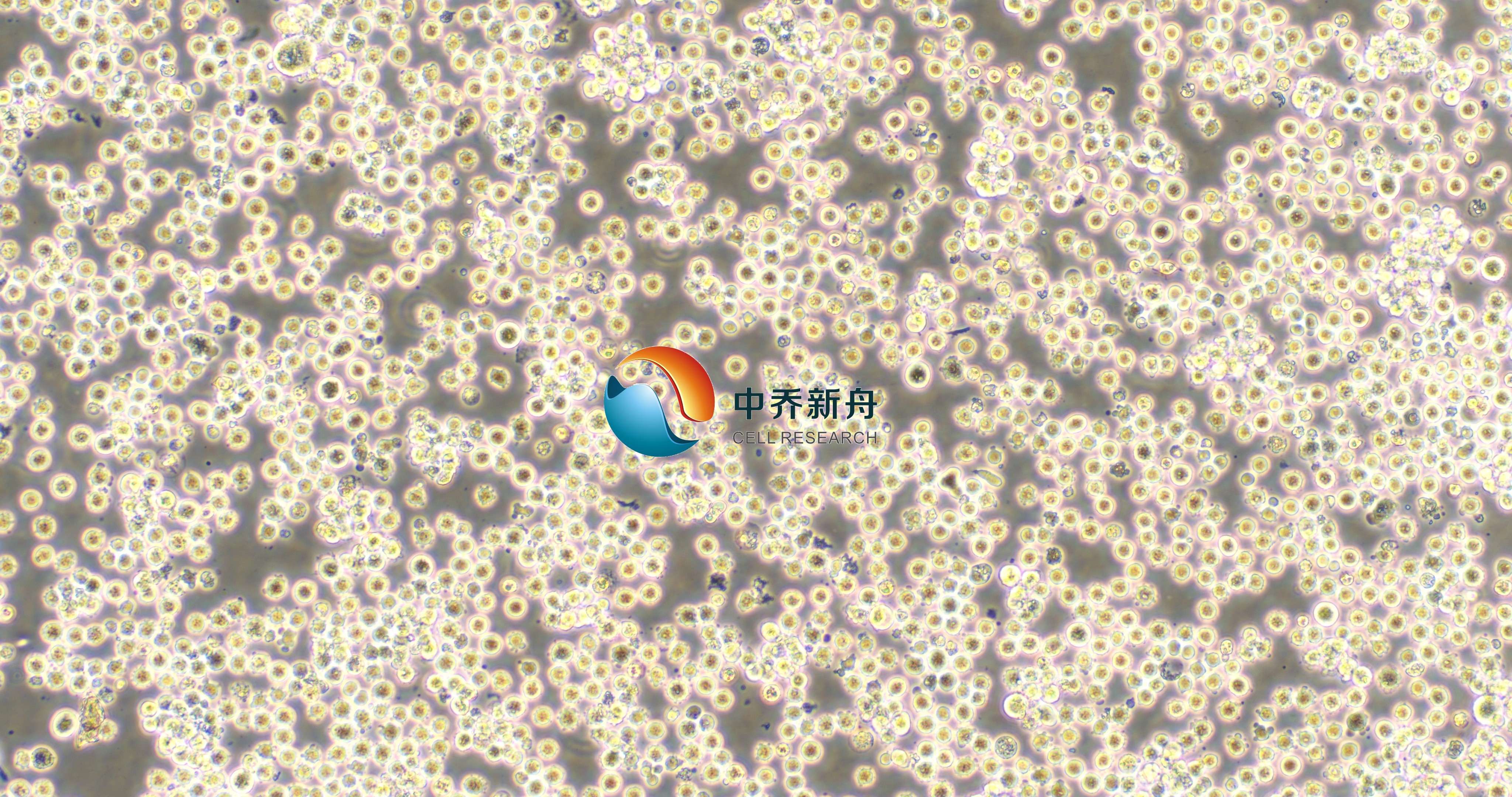 K-562-GFP+LUC人慢性髓原白血病细胞-绿色+荧光素酶标记