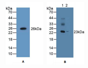 小鼠非转移细胞5表达NM23A蛋白(NME5)多克隆抗体