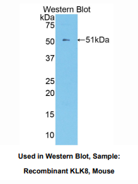 https://msimg.bioon.com/bionline/goods-no-pic.png