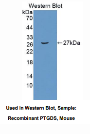 https://msimg.bioon.com/bionline/goods-no-pic.png