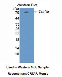 https://msimg.bioon.com/bionline/goods-no-pic.png