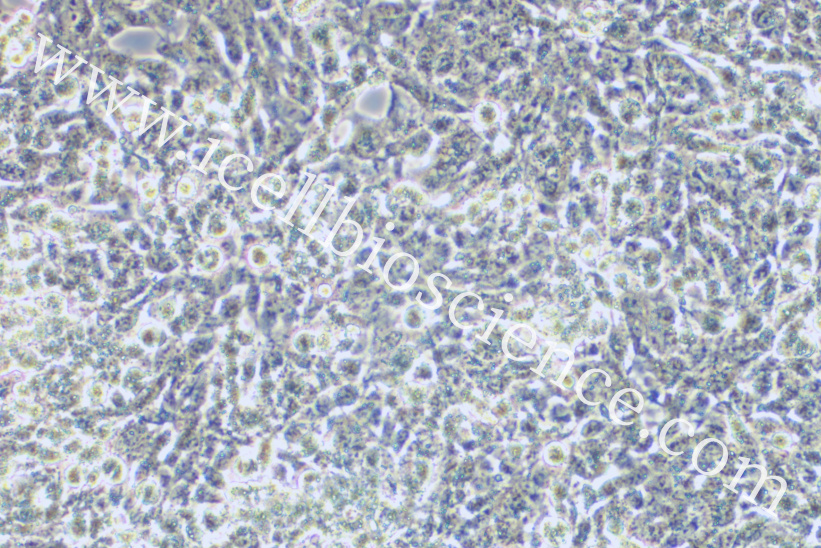 SW-756细胞/SW756细胞/SW-756/SW756/人子宫鳞状癌细胞