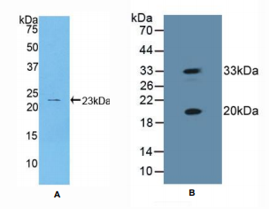 人热休克蛋白β2(HSPb2)多克隆抗体