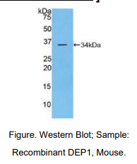 https://msimg.bioon.com/bionline/goods-no-pic.png