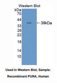 https://msimg.bioon.com/bionline/goods-no-pic.png