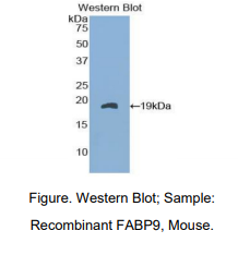 https://msimg.bioon.com/bionline/goods-no-pic.png