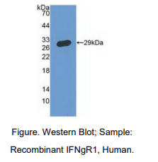 https://msimg.bioon.com/bionline/goods-no-pic.png