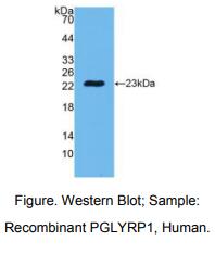 人肽聚糖识别蛋白1(PGLYRP1)多克隆抗体