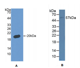 人衰老关键蛋白5(FBLN5)多克隆抗体