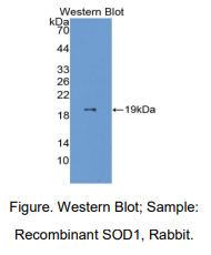 https://msimg.bioon.com/bionline/goods-no-pic.png