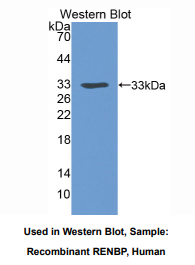 人肾素结合蛋白(RENBP)多克隆抗体