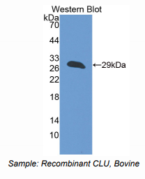 https://msimg.bioon.com/bionline/goods-no-pic.png