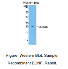 兔脑源性神经营养因子(BDNF)多克隆抗体