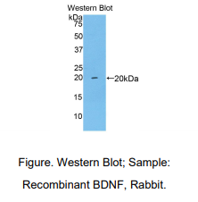 https://msimg.bioon.com/bionline/goods-no-pic.png