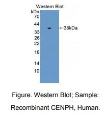 人着丝粒蛋白H(CENPH)多克隆抗体