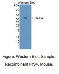 https://msimg.bioon.com/bionline/goods-no-pic.png