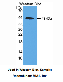 https://msimg.bioon.com/bionline/goods-no-pic.png