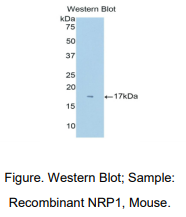 https://msimg.bioon.com/bionline/goods-no-pic.png