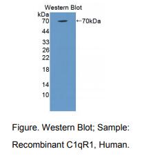 人补体成分1q受体(C1qR1)多克隆抗体