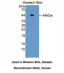 https://msimg.bioon.com/bionline/goods-no-pic.png