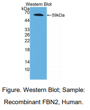 https://msimg.bioon.com/bionline/goods-no-pic.png