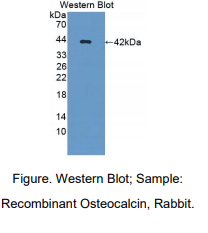 兔骨钙素(OC)多克隆抗体