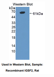 https://msimg.bioon.com/bionline/goods-no-pic.png