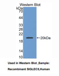 https://msimg.bioon.com/bionline/goods-no-pic.png